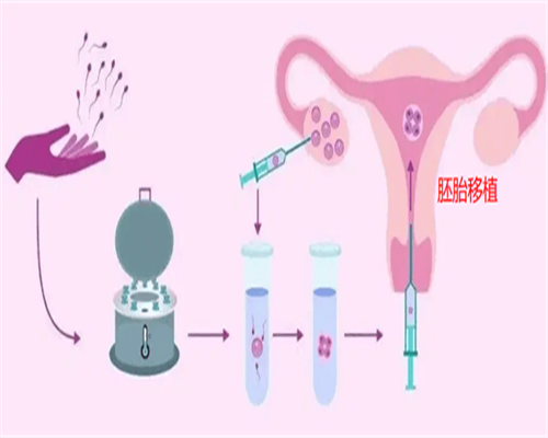供精借卵助孕：提升成功率与遗传病预防